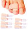 Reppkyh 7 Pieces Hammer Toe Straightener for Crooked Toes, Hammer Toe Wraps Toe Traps Toe Splints