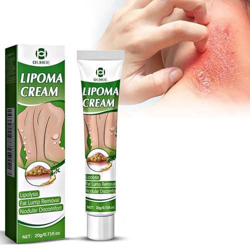 Antimykotische Creme 20 g, Effektive Behandlung gegen Leistenflechte, Ringelflechte, Ekzeme, Fußpilz, lindert Juckreiz, antimykotische Hautcreme lindert schnell Pilzbefall an Körper und Gesicht