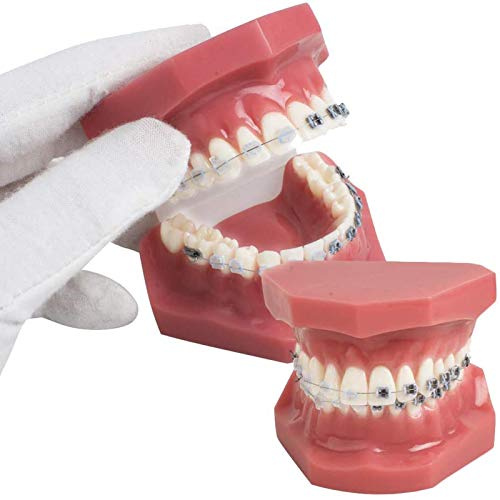 Resin Zähne Dental-Modell Demonstration Modell Zähne KFO-Studie Teach mit dem Metall und Keramik-Support, Rot 7.5 * 6.2 * 6.5cm