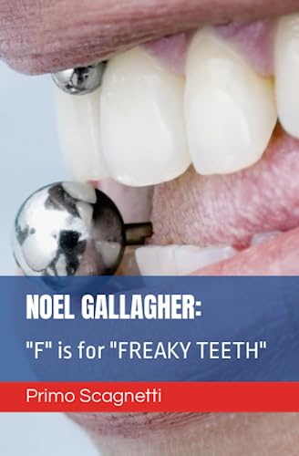 NOEL GALLAGHER: F is for FREAKY TEETH