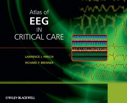 Atlas of EEG in Critical Care (English Edition)
