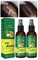 XIRUJNFD Shouga Kingu Hair Growth Oil, King of Ginger 7 Days Hair Growth, Shougagro Japanese Hair Growth Spray, Ginger Oil for Hair Growth, Anti-Hair Loss Oil (2Pcs)