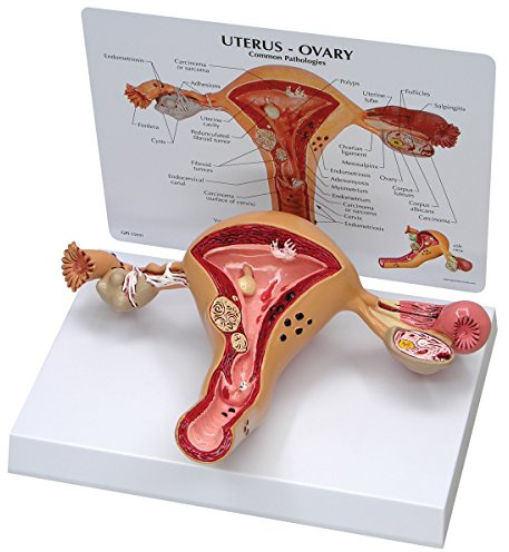 GPI Anatomicals W33352 Uterus Modell