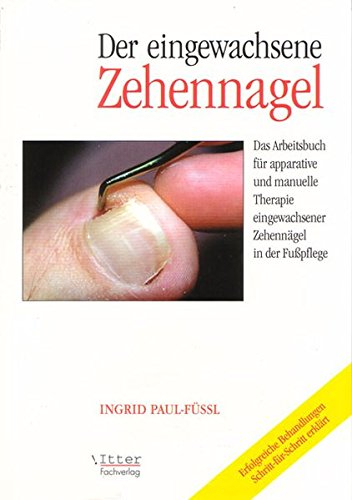Der eingewachsene Zehennagel Das Arbeitsbuch für apparative und manuelle Therapie eingewachsener Zehennägel in der Fußpflege