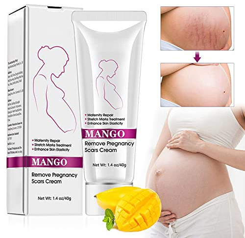 Crema cicatrice Smagliature, Rimozione Cicatrici Da Gravidanza, Trattamento Smagliature, Riparazione Maternità, Rimozione Smagliature Dalla Gravidanza