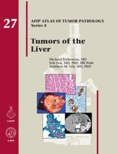Tumors of the Liver (AFIP Atlas of Tumor Pathology, Series 4,)
