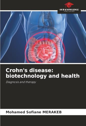Crohn's disease: biotechnology and health: Diagnosis and therapy