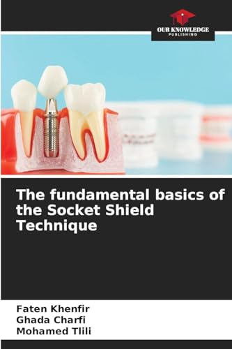 The fundamental basics of the Socket Shield Technique