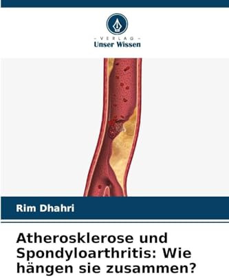 Atherosklerose und Spondyloarthritis: Wie hängen sie zusammen?: DE