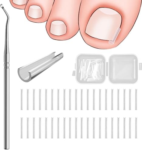 40 Pcs Unghie Incarnite Piedi Strisce Correttore Per Unghie Incarnite Unghie Piedi Incarnite Unghie Incarnite Piedi Unghie Incarnite Piedi Attrezzi Per Pedicure Con Sollevatore Per Unghie Incarnite
