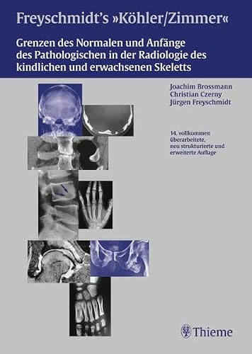 Freyschmidts Köhler/Zimmer: Grenzen des Normalen und Anfänge des Pathologischen: Joachim Brossmann, Christian Czerny, Jürgen Freyschmidt
