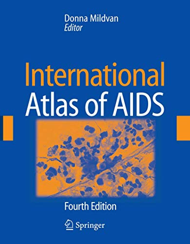 International Atlas of AIDS (Mildvan, International Atlas of AIDS)