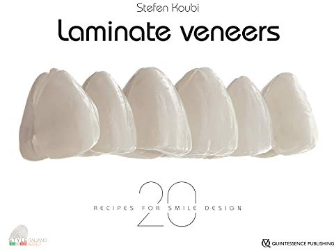 Laminate Veneers: 20 Recipes for Smile Design