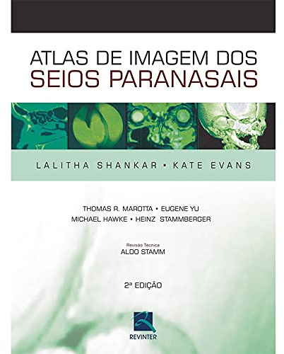 Atlas De Imagens Dos Seios Paranasais