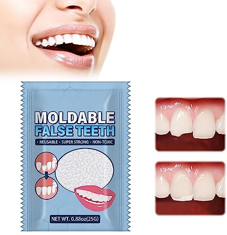Kit Di Riempimento Temporaneo Dente, Dente Provvisorio, Kit Otturazione Denti, Denti Finti Modellabili Per il Fissaggio, Riempimento Del Dente Rotto Mancante, Scatto Istantaneo e Sorriso Sicuro,25g