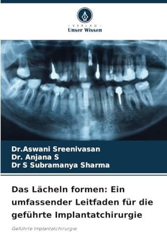 Das Lächeln formen: Ein umfassender Leitfaden für die geführte Implantatchirurgie: Geführte Implantatchirurgie