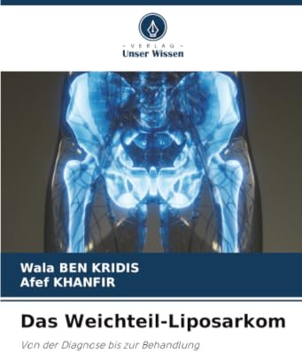 Das Weichteil-Liposarkom: Von der Diagnose bis zur Behandlung