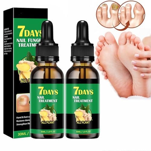 Ginger Nail Treatment Nail Support Nail Care, Ginger Nail Serum, Toe Ginger Nail Care are Strength Fast Acting, Nail Strengthener For Damaged Nails, Ginger Nail Essence