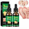 Ginger Nail Treatment Nail Support Nail Care, Ginger Nail Serum, Toe Ginger Nail Care are Strength Fast Acting, Nail Strengthener For Damaged Nails, Ginger Nail Essence