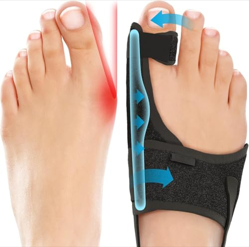SUNNYYDS 2-Pack Bunion Corrector for Women & Men, Orthopedic Bunion Splint for Hallux Valgus Pain Relief, Big Toe Separator, Adjustable Day/Night Support, Comfortable Hammer Toe Straightener
