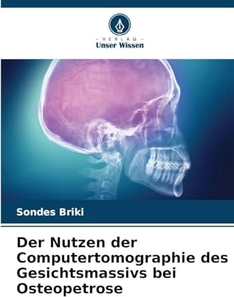 Der Nutzen der Computertomographie des Gesichtsmassivs bei Osteopetrose