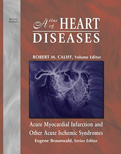 Atlas of Heart Diseases: Acute Myocardial Infarction and Other Acute Ischemic Syndromes (Atlas of Heart Diseases (Unnumbered).)