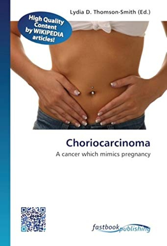 Choriocarcinoma: A cancer which mimics pregnancy