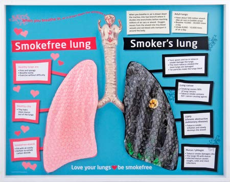 Stop Smoking Smokefree and Smoker’s Lung Display
