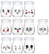 Flliberté 10 Pot de Yaourt vide, Pot de Yaourt en Verre avec Couvercle hermétique, petit Pot de Yaourt emoticone pour Multicuiseur Thermomix, Cookéo, Yaourt Maison (100ml)