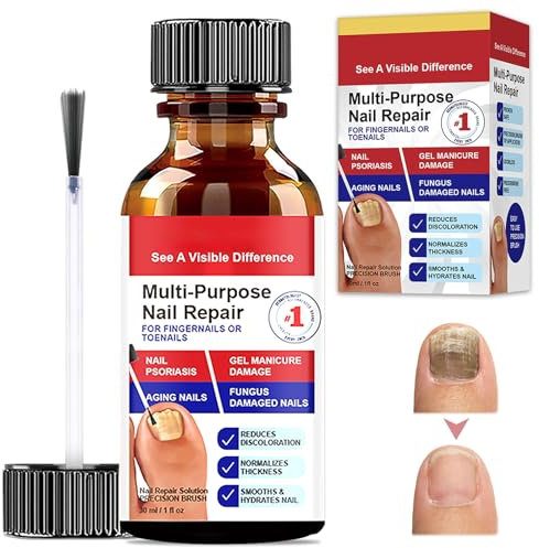 Ongles Réparateurs, Ongles Réparateurs pour Ongles, Régénére et Renforce L'Ongle, Restaure L'aspect Naturel de L'ongle, Soin Pied, Application Facile Au Pinceau, 30ml, Rrouge