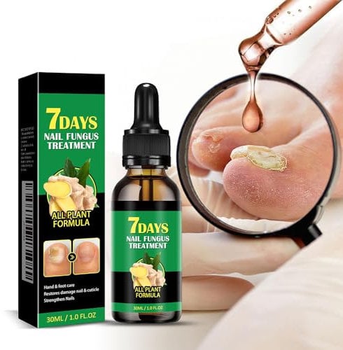 Toenail Fungus Treatment Extra Strength-7 days nail fungus treatment,Ginger Nail Treatment,Toenail Cuticle Care Oil Care,Multi-Purpose Nail Repair for Your nails a Natural Shine-1 fl oz (L)