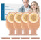 20 pièces Sacs de colostomie, poche de stomie drainables anti-fuite avec 8 pinces, fournitures de stomie en une seule pièce pour les soins de stomie d'iléostomie, coupe à la taille