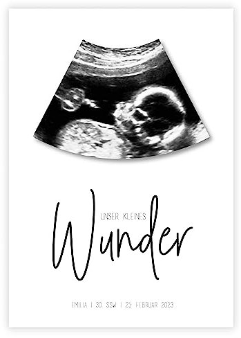 Personalisiertes Bild „Ultraschall Schwangerschaft”, Schwangerschaft, Baby, Geburtsdaten, Mädchen, Junge, Kinderzimmer, Deko, SSW, kleines Wunder, mit und ohne Bilderrahmen