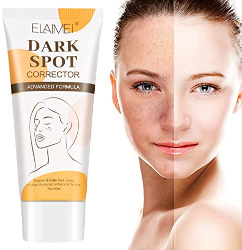Anti Macchie Crema, Schiarente Viso, Anti-lentiggini, Utilizzato per Tono Della Pelle Irregolare, Rimozione Macchie Scure, Anti-melanina, Sbiancante -50ml
