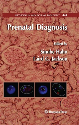 Prenatal Diagnosis (Methods in Molecular Biology Book 444) (English Edition)