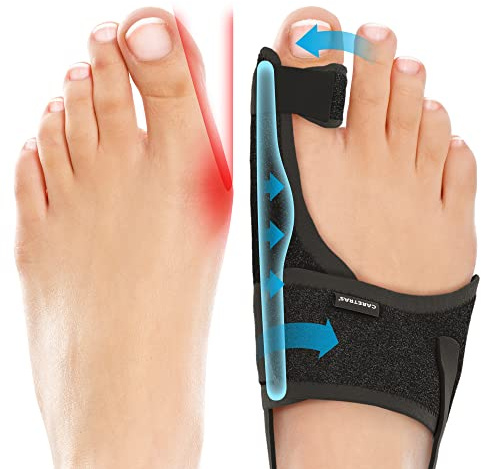 Caretras 2-Pack Bunion Corrector for Women & Men, Orthopedic Bunion Splint for Hallux Valgus Pain Relief, Big Toe Separator, Adjustable Day/Night Support, Comfortable Hammer Toe Straightener