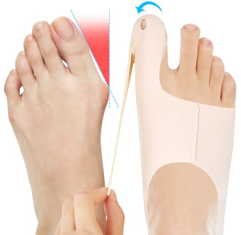 SOARFLY Hallux Valgus Korrektur, Verstellbar Hallux Valgus Schiene, Hallux Valgus Bandage,mit Rutschfestem Fersenriemen, Linderung von Schmerzen bei Hallux Valgus, für Fußprobleme,Tag & Nacht (S)