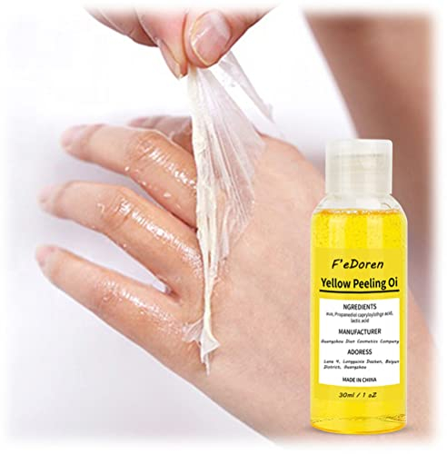 Yidoo Gelbes Peeling-Öl mit Fruchtsäuren, peelt die Haut und strafft die Poren, superstarkes Peeling-Öl, das dunkle Haut für alle Hauttypen abblättert
