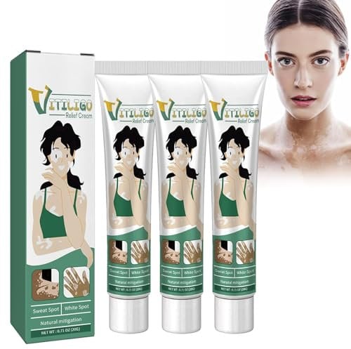 Grgowe 3pcs Crema Per Il Trattamento Della Vitiligine,Crema Per La Vitiligine,Crema Per La Cura Della Vitiligine,Unguento Per La Cura Della Vitiligine,Per Alleviare Le Macchie Bianche Sulla Pelle
