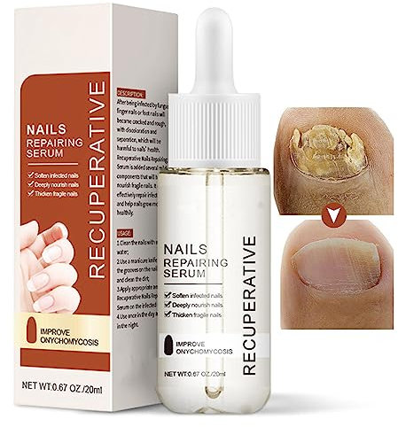 Nail Growth and Strengthening Serum, 20ml Nails Repair Serum, Fungal Nail Treatment for Toenail Extra Strong, Toenail Growth Treatment for Repairing Damaged and Discolored Nails Improve Onychomycosis