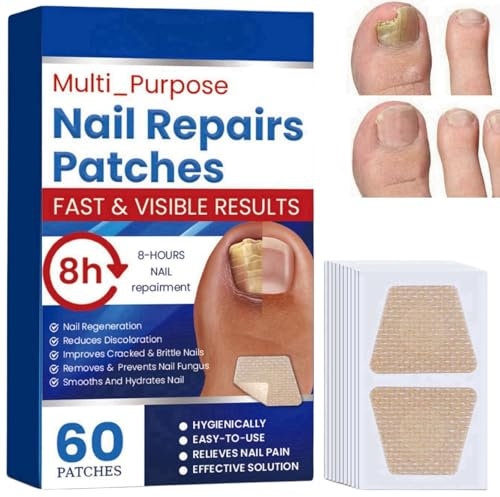 60PCS Nail Repair Patches,Overnight Nail Repair Restores Healthy Nails,Fungal Nail Treatment,Nail Fungus Treatment for Toenail,Toe Nail Treatment Extra Strong for Fungal Nail,Extra Strong Nail Repair