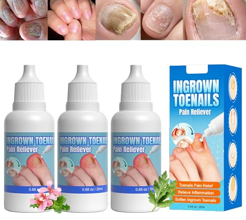 Ingrown Toenail Pain Reliever Drops Set Of 3 X 20ml - Fast-Acting Toenail Softening Solution For Thick & Ingrown Nails, Cuticle Care & Natural Nail Restoration, Easy At-Home Daily
