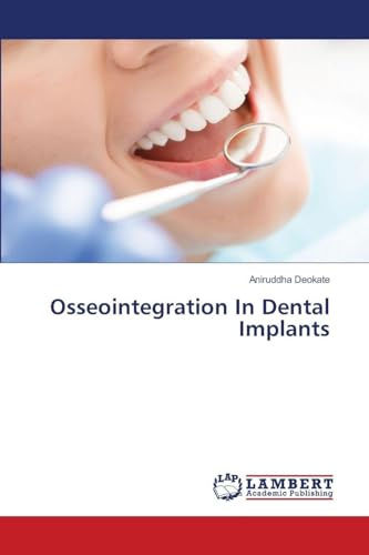 Osseointegration In Dental Implants