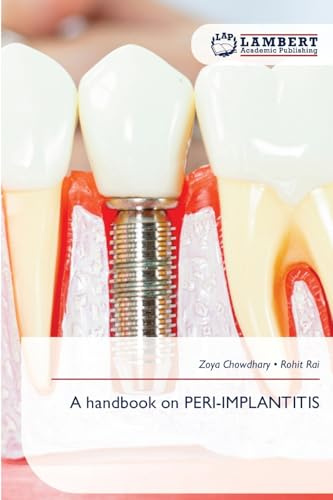 A handbook on PERI-IMPLANTITIS: DE