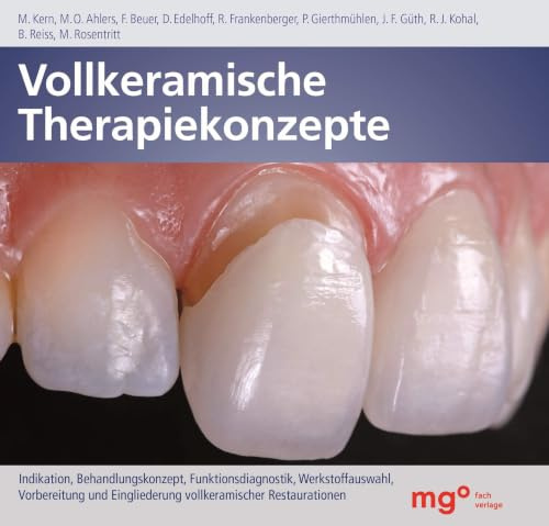 Vollkeramische Therapiekonzepte: 2. Auflage 2026 deutsch - Indikation, Behandlungskonzept, Funktionsdiagnostik, Werkstoffauswahl, Vorbereitung und Eingliederung vollkeramischer Restaurationen