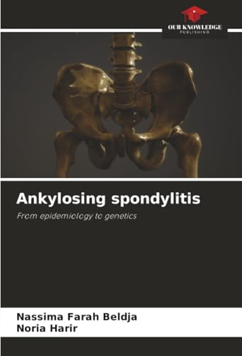 Ankylosing spondylitis: From epidemiology to genetics