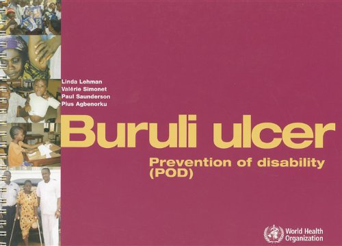 Buruli Ulcer: Prevention of Disability Pod