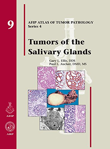Tumors of the Salivary Glands (AFIP Atlas of Tumor Pathology: Series 4)