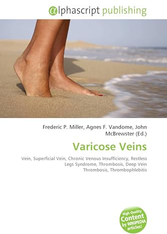 Varicose Veins: Vein, Superficial Vein, Chronic Venous Insufficiency, Restless Legs Syndrome, Thrombosis, Deep Vein Thrombosis, Thrombophlebitis
