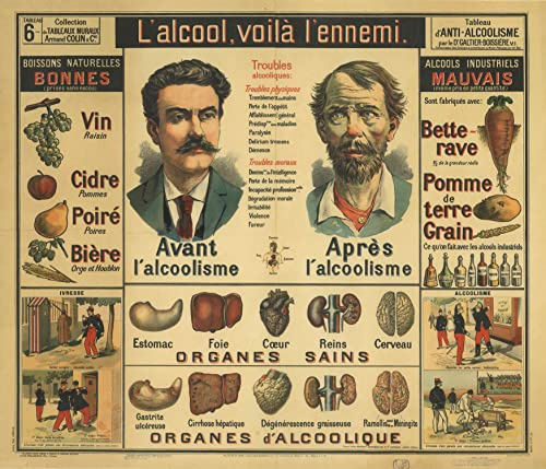 Vintage Schulposter Anatomie - Poster Wanddeko A3+ (32 x 45 cm) zum Verschönern und Dekorieren Ihres Zuhauses. (Alkkolism-1)